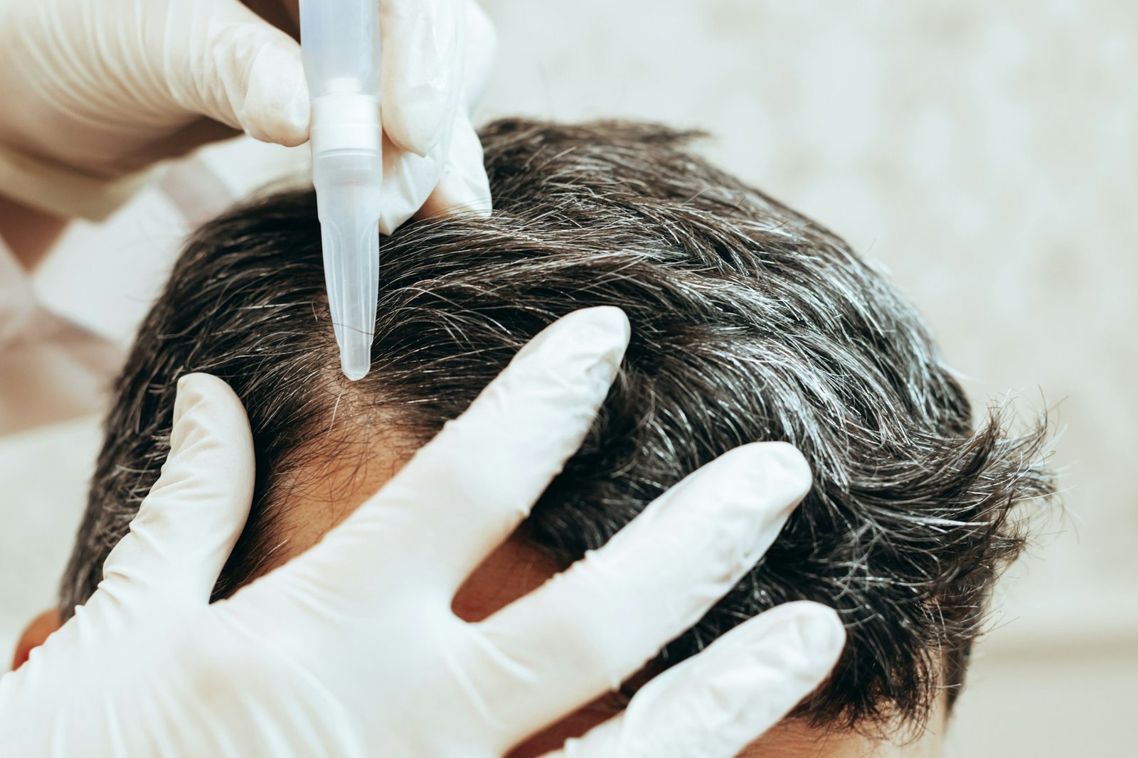 A cosmetologist performs anti-aging procedures, applies hyaluronic acid serum to the scalp