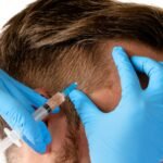 Man receiving scalp injection for hair grow