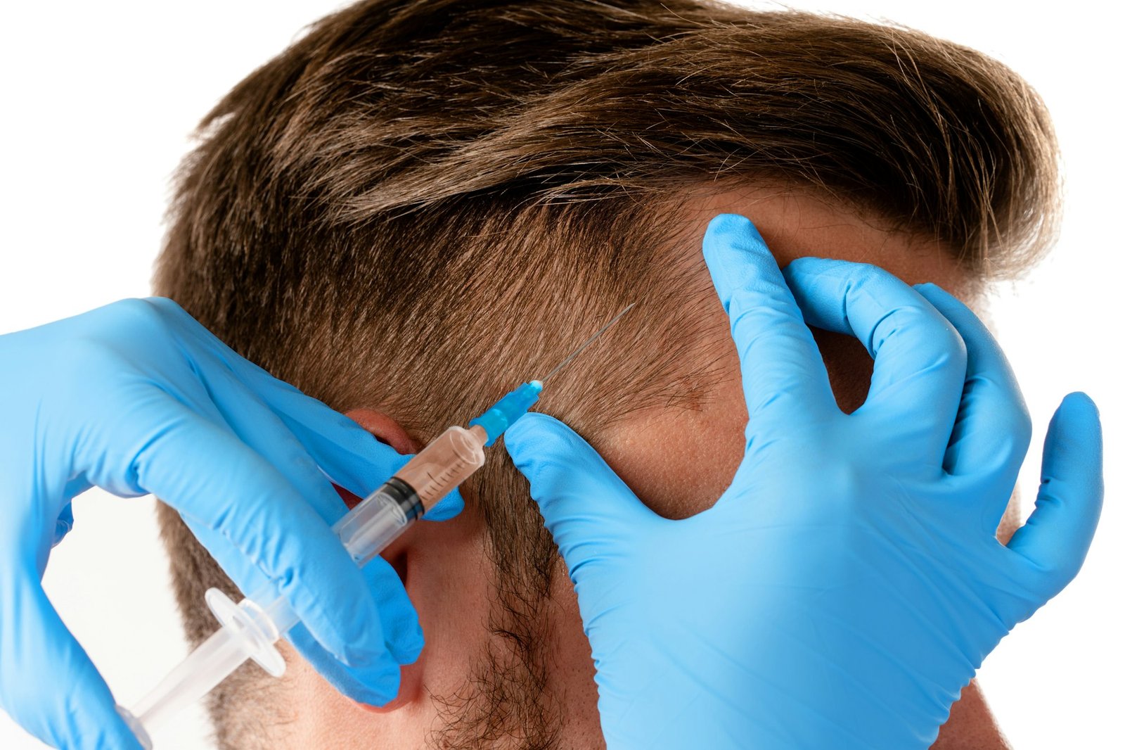 Man receiving scalp injection for hair grow