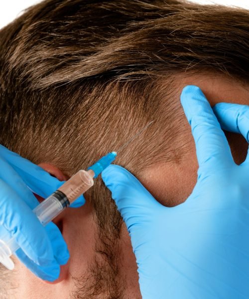 Man receiving scalp injection for hair grow